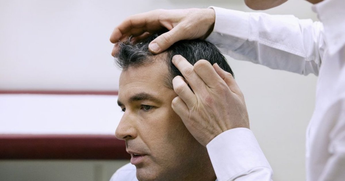 23 Hair Loss Statistics that Will Surprise You