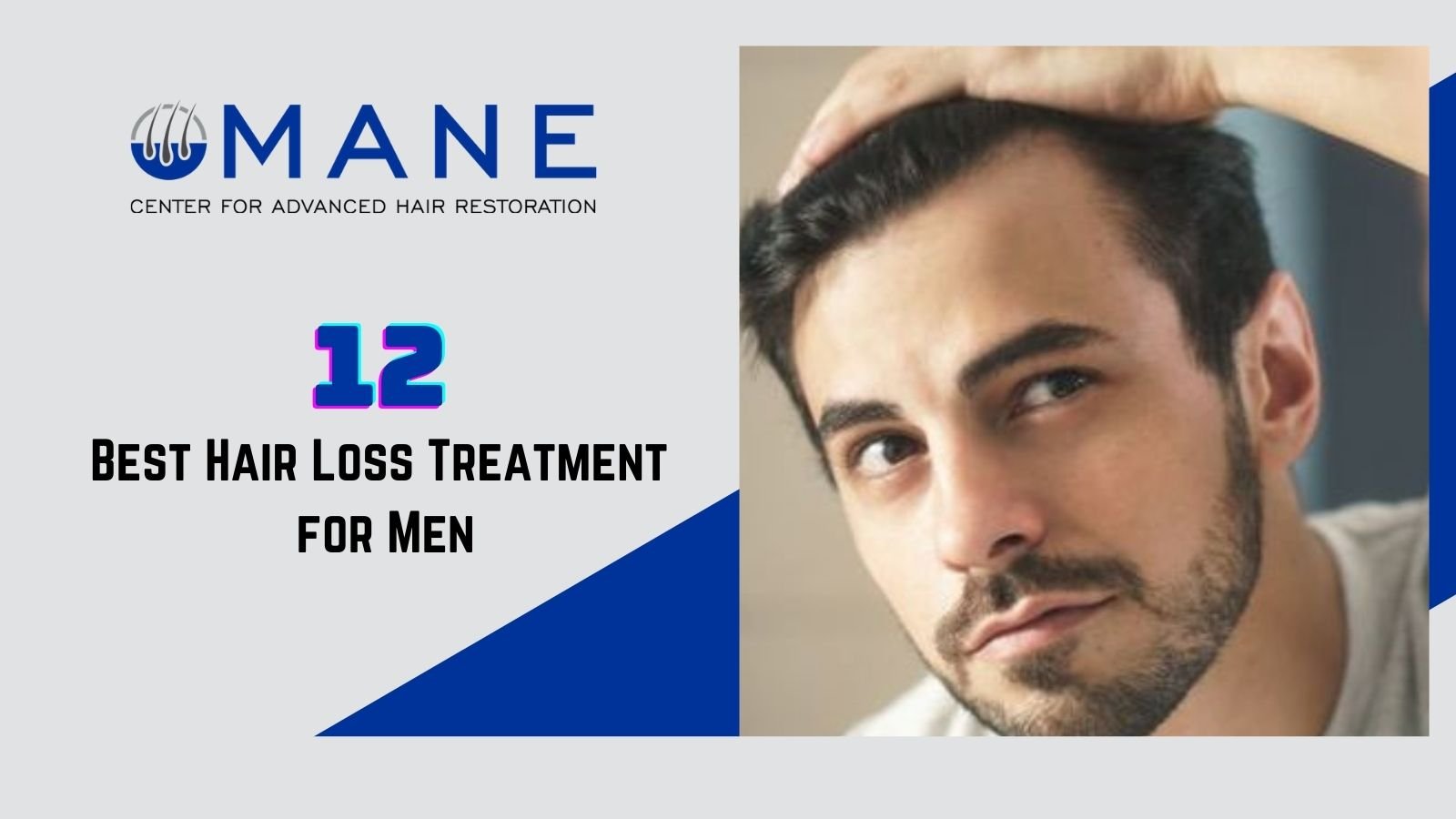 12 Best Hair Loss Treatment for Men