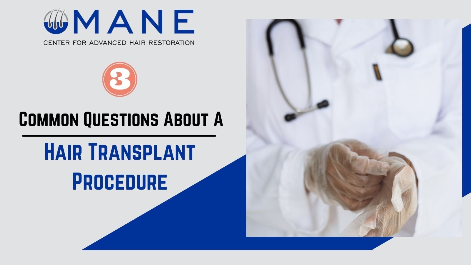 3 Common Questions About A Hair Transplant Procedure