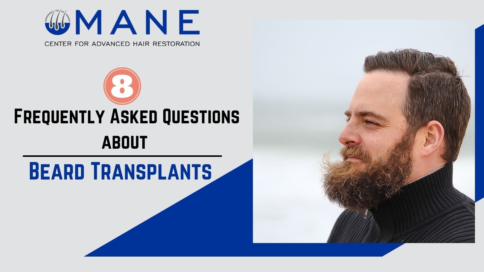 8 Frequently Asked Questions about Beard Transplants