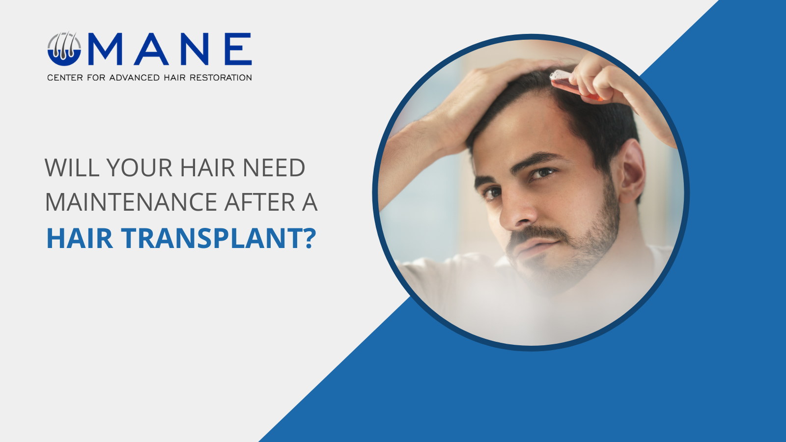 Will Your Hair Need Maintenance after a Hair Transplant ?