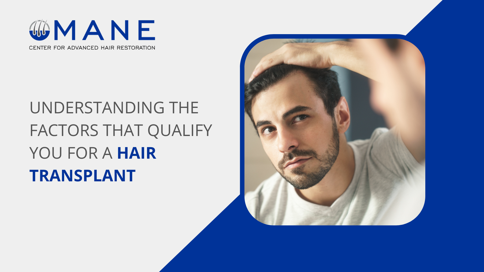 Understanding the Factors That Qualify You for a Hair Transplant 
