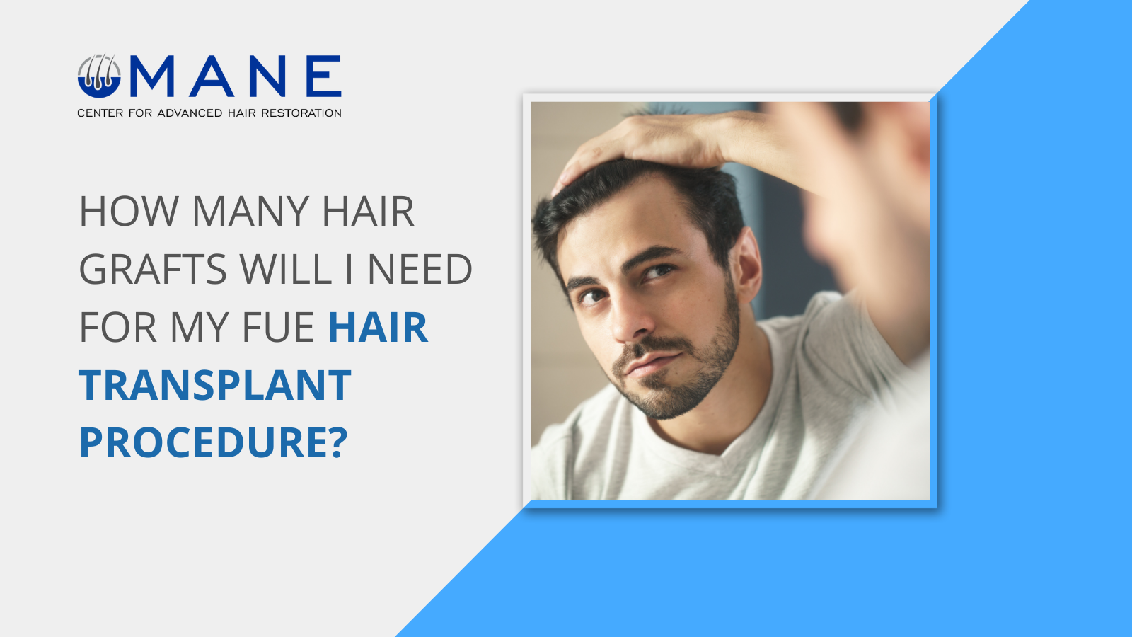 How Many Hair Grafts Will I Need for My FUE Hair Transplant Procedure?