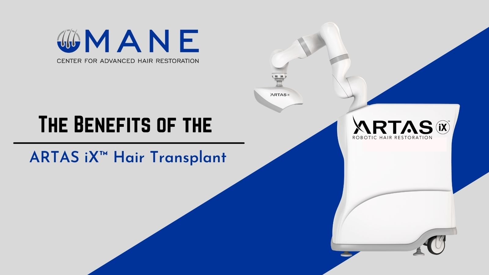 The Benefits of the ARTAS iX™ Hair Transplant