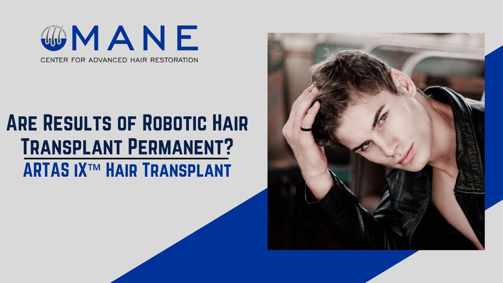 Are Results of Robotic Hair Transplant Permanent?