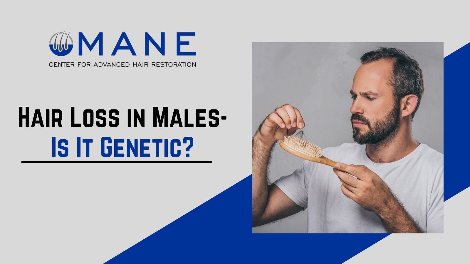Hair Loss in Males– Is It Genetic?
