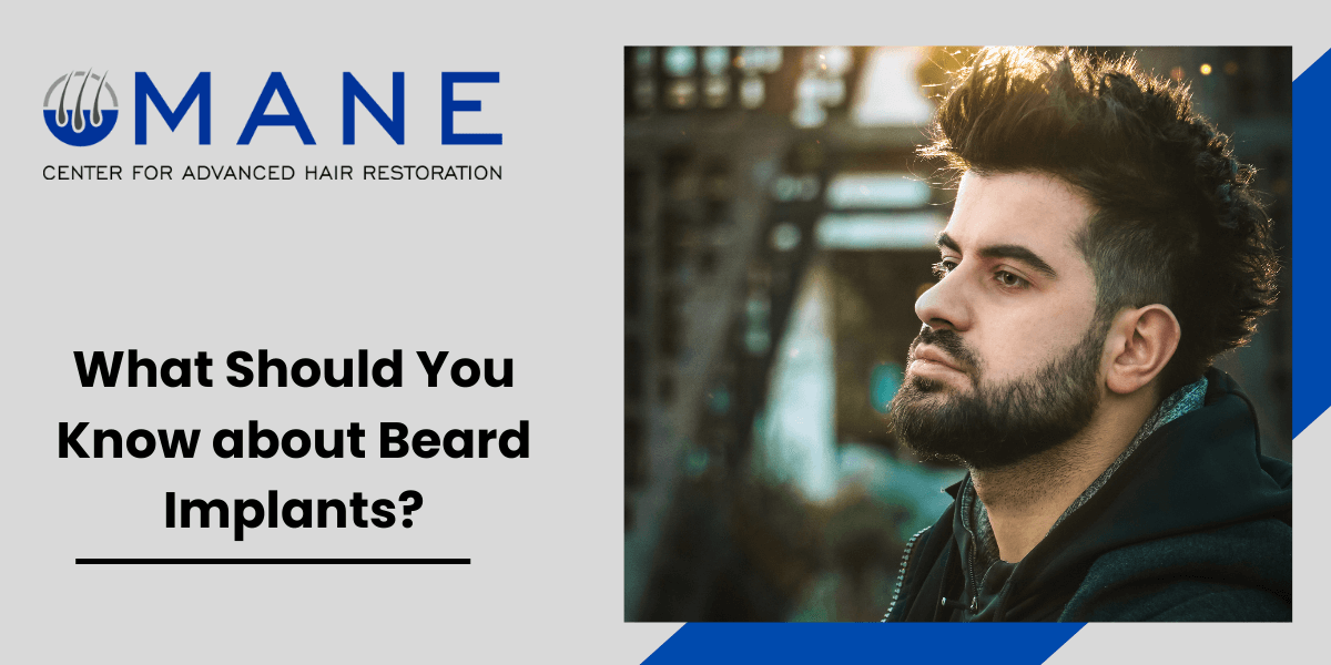 What Should You Know about Beard Implants?