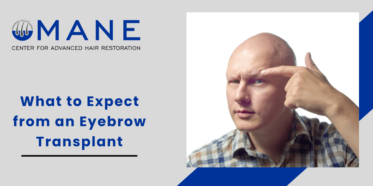 What to Expect from an Eyebrow Transplant