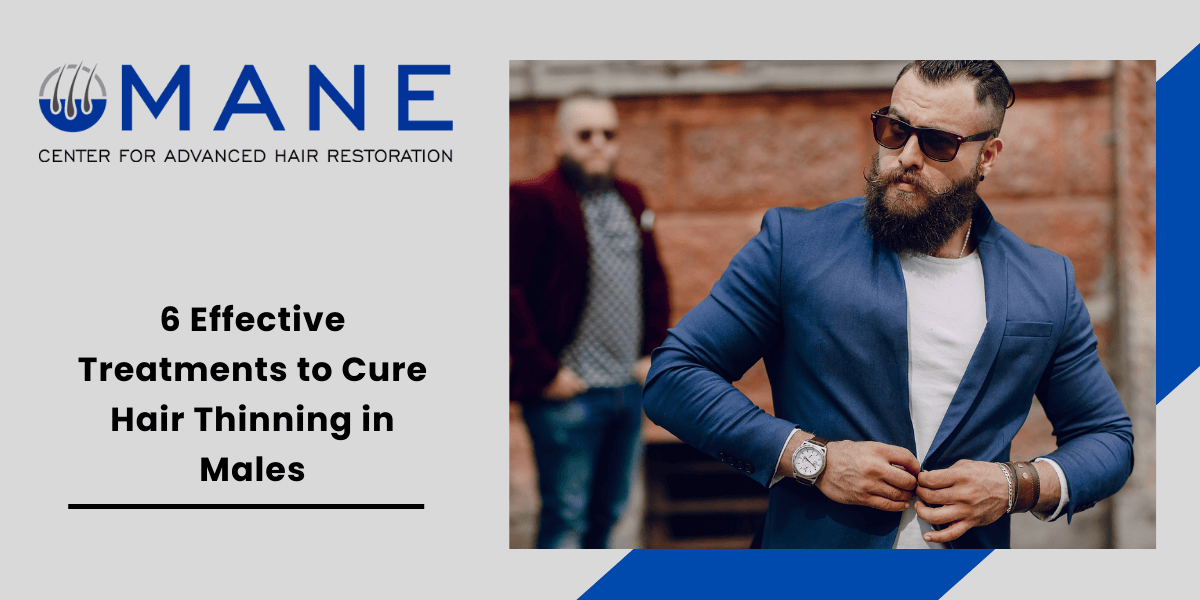 6 Effective Treatments to Cure Hair Thinning in Males