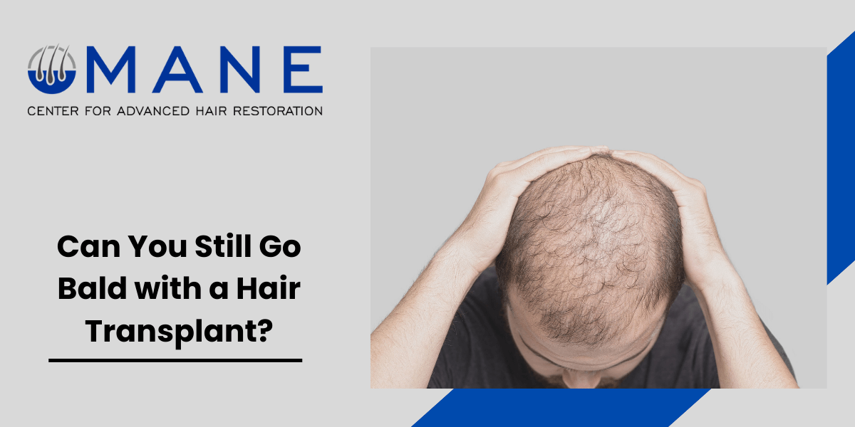 Can You Still Go Bald with a Hair Transplant?