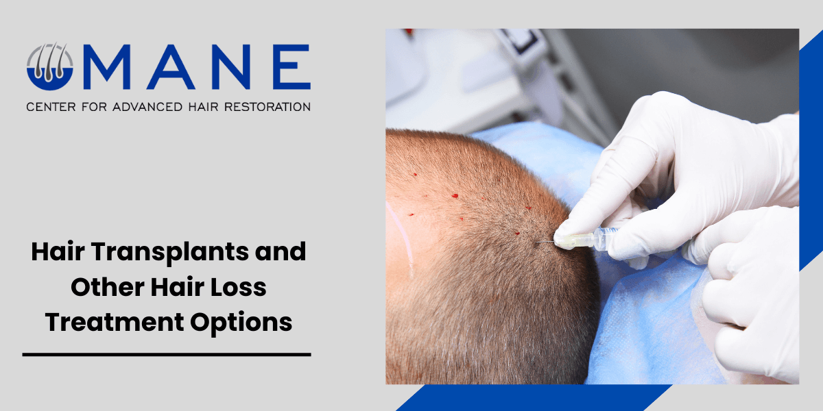 Hair Transplants and Other Hair Loss Treatment Options
